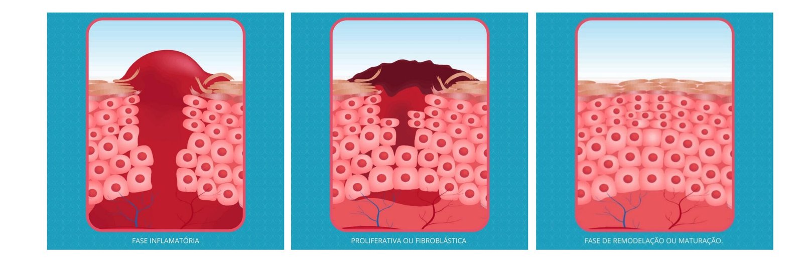 2d99a719_comosecarsuafitanullscar.png